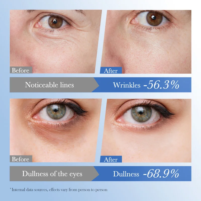 Caviar Eye Bag Removal Cream Hyaluronic Acid Anti-Wrinkle Firming Skin Fade Fine Lines Anti Dark Circle Puffiness Eye Care 20g - view 4