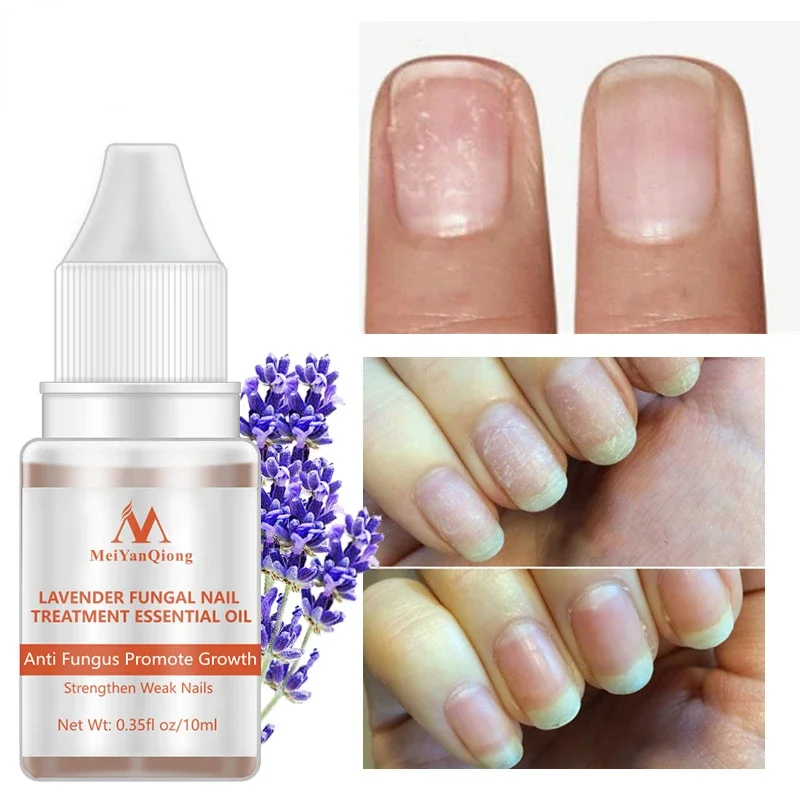 1 Fles 10Ml Gedroogde Bloemen Verzachter Nutritionele Nagelriemolie Behandeling Voedzame Gel Polish Cuticula Nail Art Tool Nagelverzorging Olie