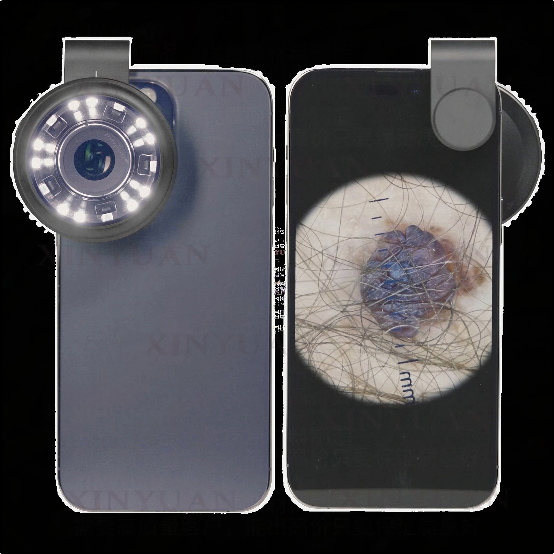 4 lenses 4 sets of cross 10x magnification Aluminum optical glass Electric pocket mini skin mirror