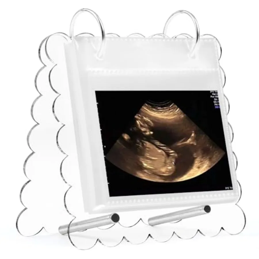 

Flip Ultrasound Photo Album with Stand, Refillable Flip-Through Display for 3x4 Pictures, Acrylic Scalloped Cover, Pregnancy Gi