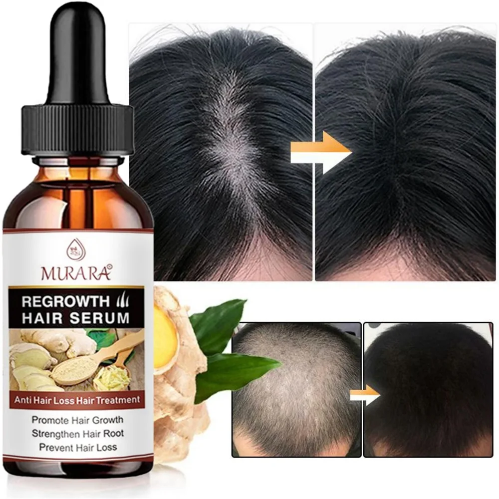 

Anti-Hair Loss Essential Oil Dredges Hair Follicles Hair Growth Serum Hair Treatement Oil