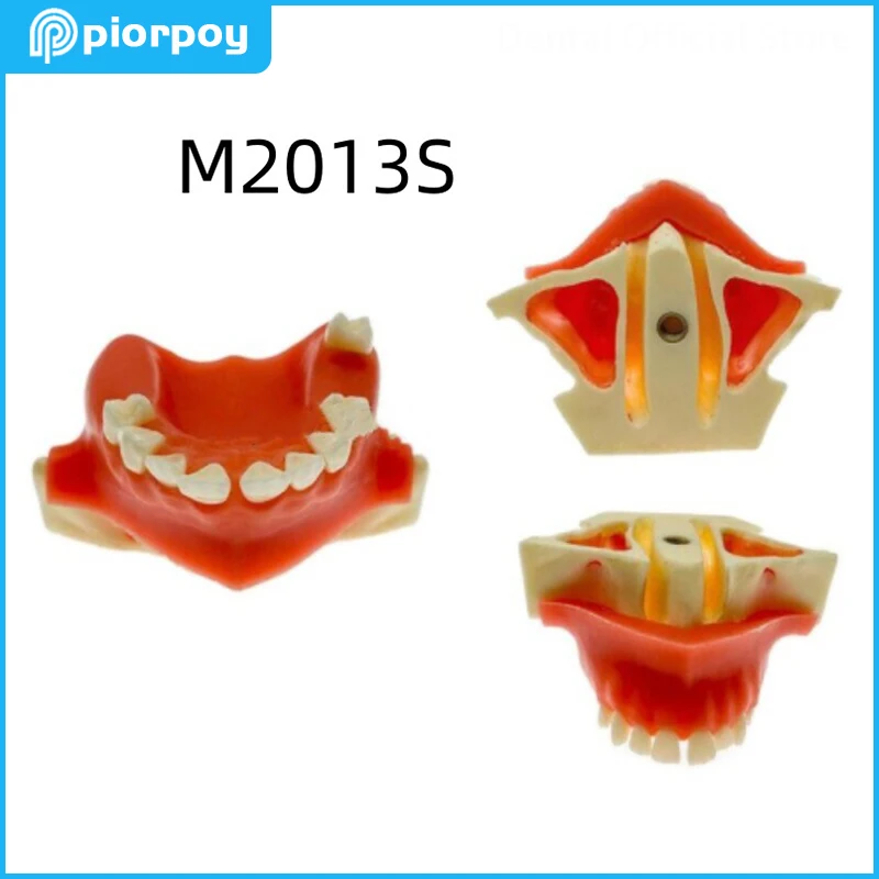 

Dental Teaching Teeth Models Soft Gums Sinus Lifting Implant Practice Model for Dentistry Demonstration Students Training