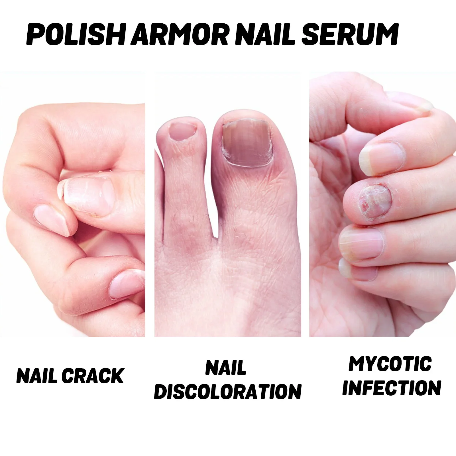 для ногтей Nail Treatments Epairing Hand and Foot Nails Decay, Soft Nail Care, Bright Nails Care, Nourishing Nail Fluid