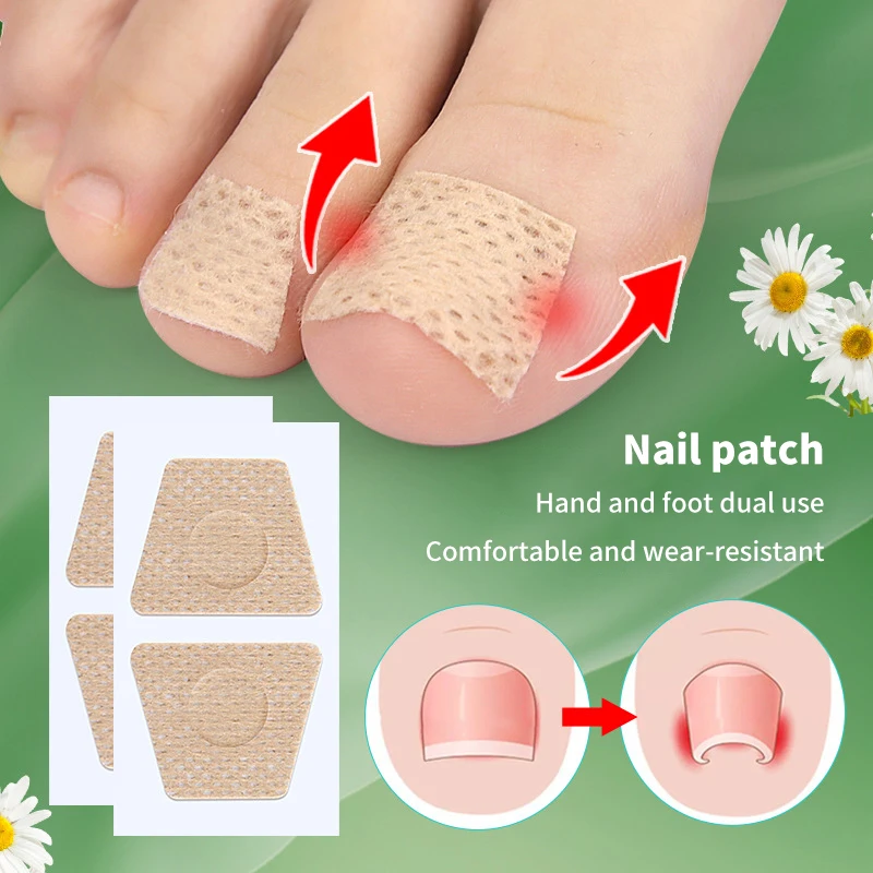 5Pairs Nail Care Patch Ingrown Toenail Correction Patch Ingrown Toe Nail Treatment Soft Nail Repair Patch Foot Care Tool