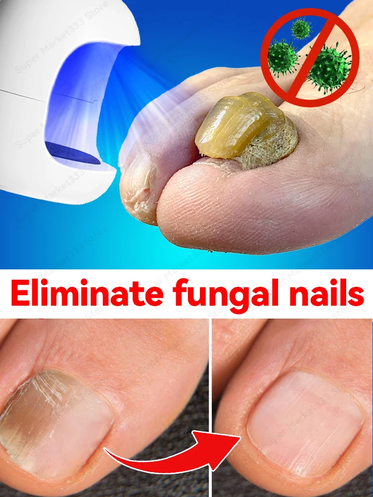 

Solves all nail problems