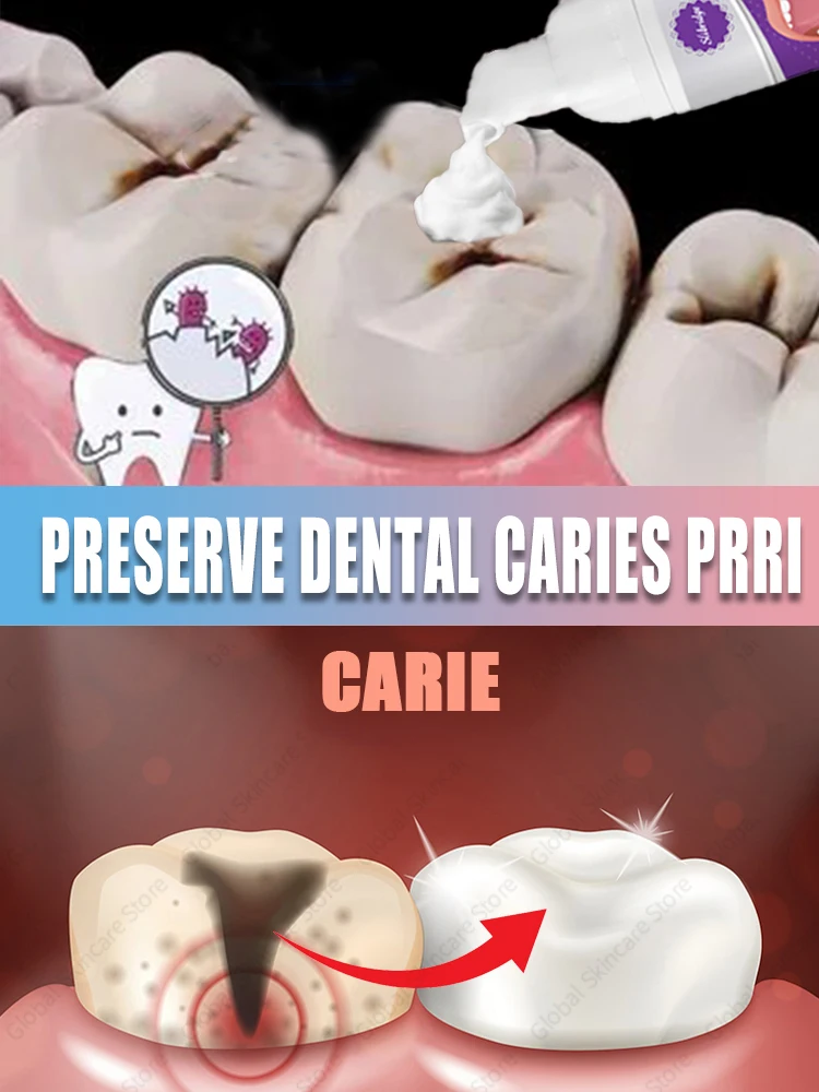 

Repair teeth, prevent tooth decay, and effectively remove dental plaque