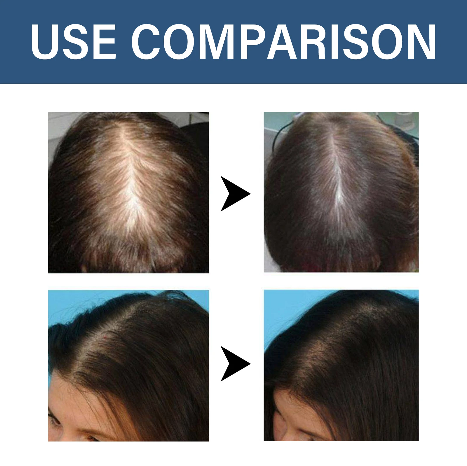Hair Thickening Treatment Caps - огляд і ціна Argan Oil Treatment