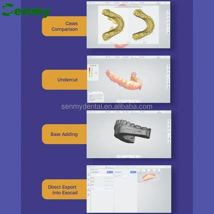 2025 new originalM501P CAD CAM Scanner Intraoral 3d Scanner Panda P3 Intra Oral Scan Lab Mini Portable Scanner with Free Softwa