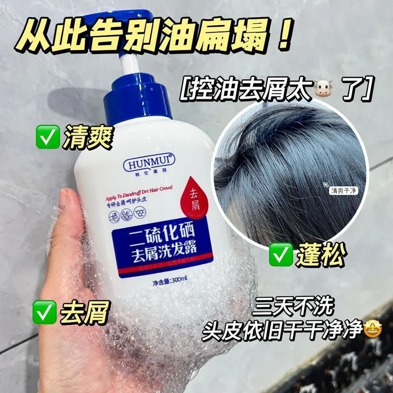 shampoo-antiforfora-e-controllo-oleosita-con-solfuro-di-selenio-per-il-cuoio-capelluto-sollievo-dal-prurito-e-cura-purificante-trattamento-per-cuoio-capelluto-secco-e-schiacciato