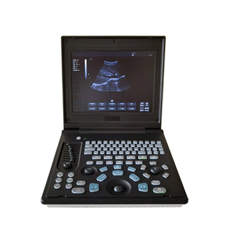 GooDoctor Notebook Full Digital Ultrasonic System 12 Inch LED LCD Screen Total Gain Regulation Human Ultrasound Machine