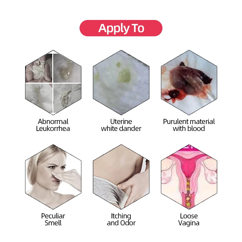 Womb Fibroids Vaginale Detox Vaginal Supository Melts Vagina Tighten Nursing Medical Gynecology Vaginitis Treatment Care