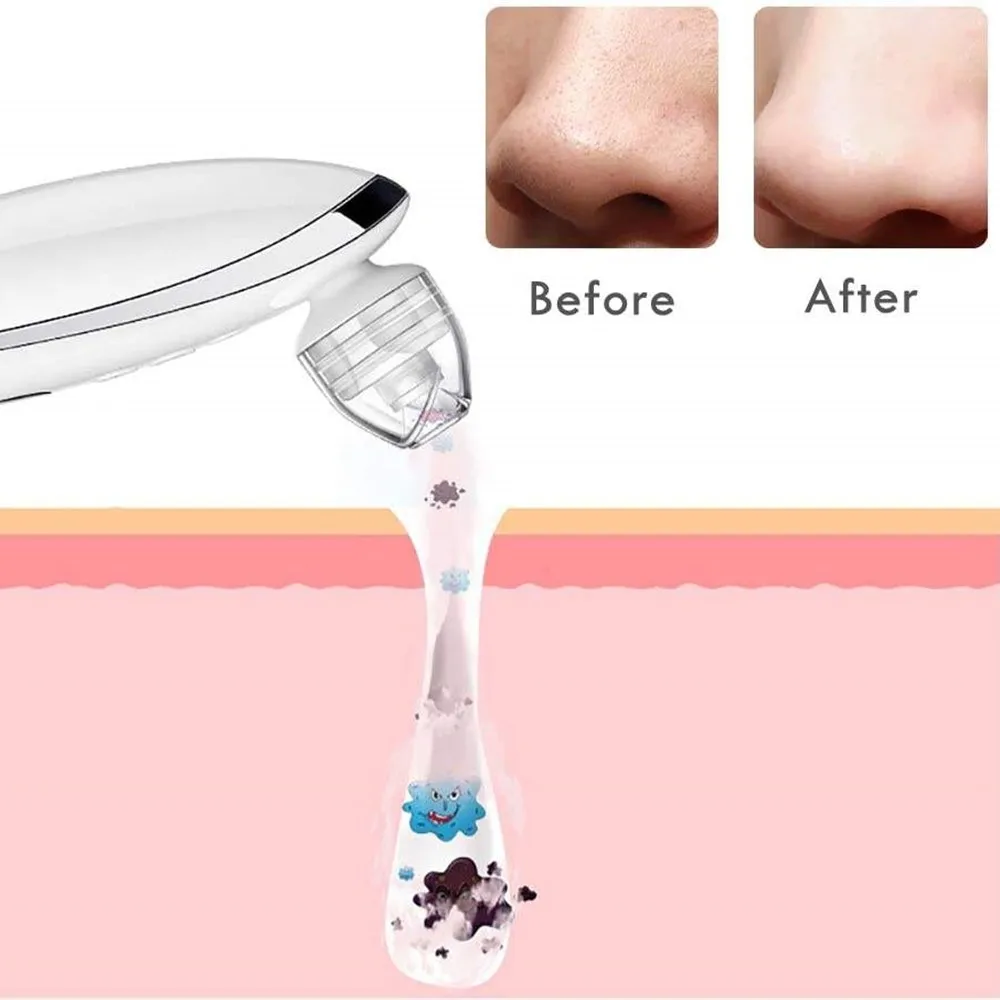 Electric Intelligent Visual Skin Care Blackhead Remover Vacuum Tool