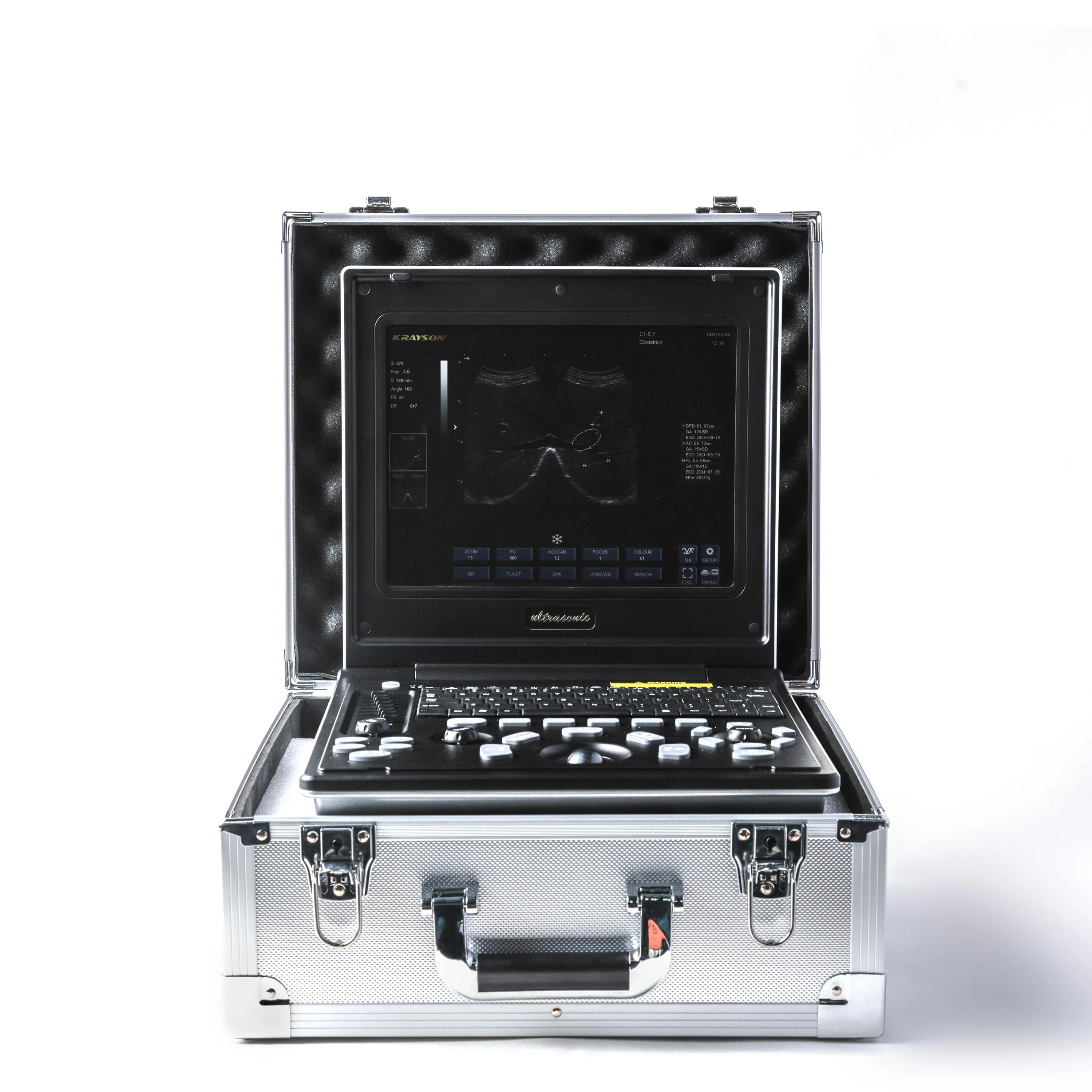 Portable 7.5 MHz Veterinary Monitoring Device Rectal Probe Scanner for Pregnancy Detection in Cattle Sheep Farm Animals
