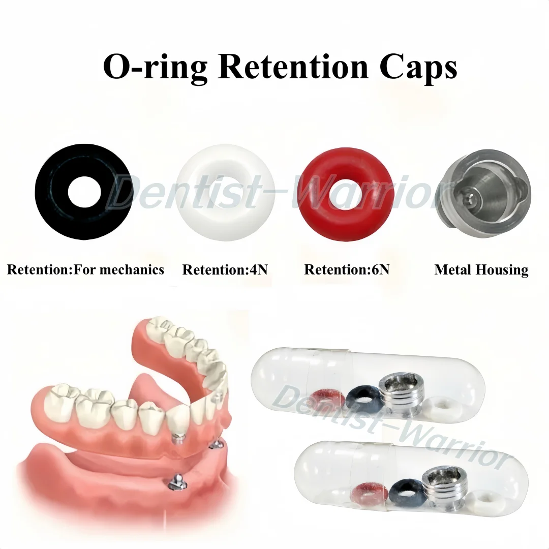 

Комплект колпачков для уплотнительных колец, фиксаторы, шарик для удержания зубного протеза, металлический корпус 4N, 4 шт./компл., подходит для Oss