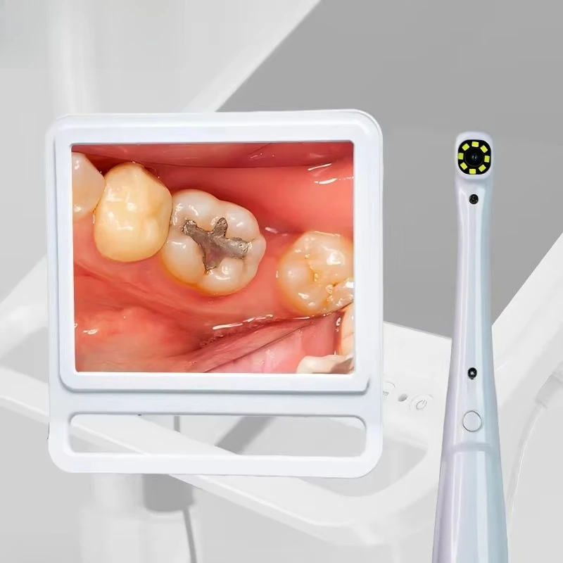 Mobile Portable  Dental Endoscope 17 Inches hd   Monitor Intra Oral Camera 360-degree Rotation Monitor Arm  for Dental Cart Unit