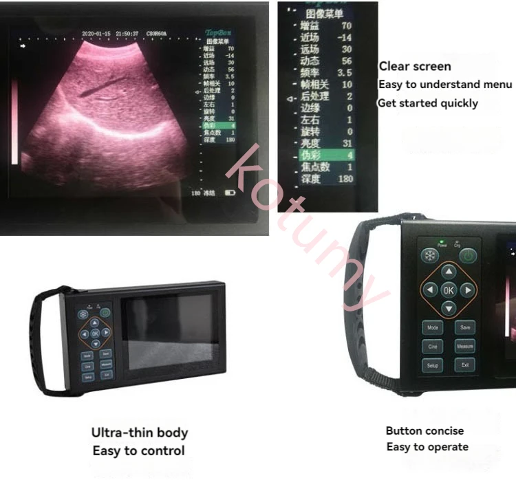 Veterinary Ultrasound Machine Ultrasound Diagnostic Instrument Animal Ultrasound Scanner for Veterinary