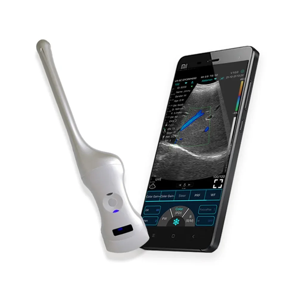 

Professional Portable Doppler 192 Elements Double Head Color Wireless Ultrasound Probe