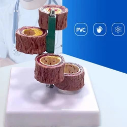 Blood Vessel Hardening Of The Arteriosclerosis Human Model Adult Anatomy Anatomical Models Medical Teaching Supplies Tools Kit