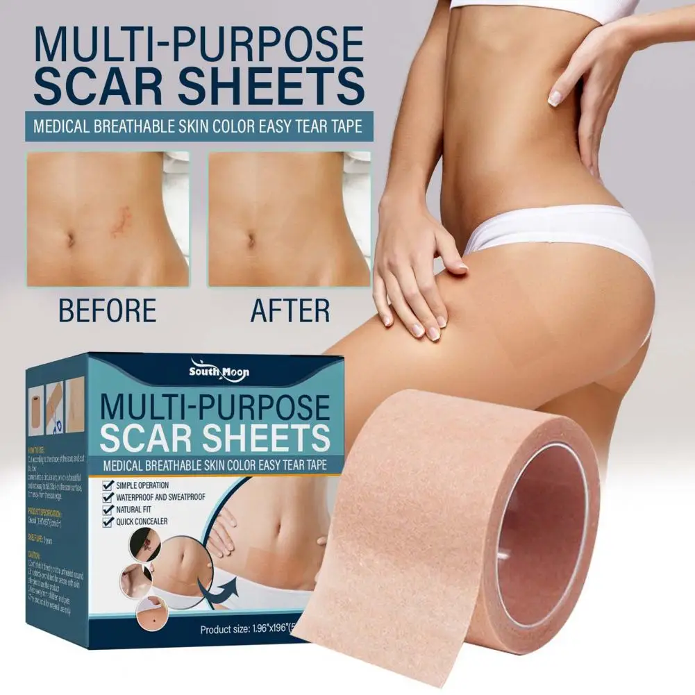 50g/Box Universal Acne Trauma Burn Scar Removal Sheet Scar Sticker Ultra-Thin  Hide Flaws