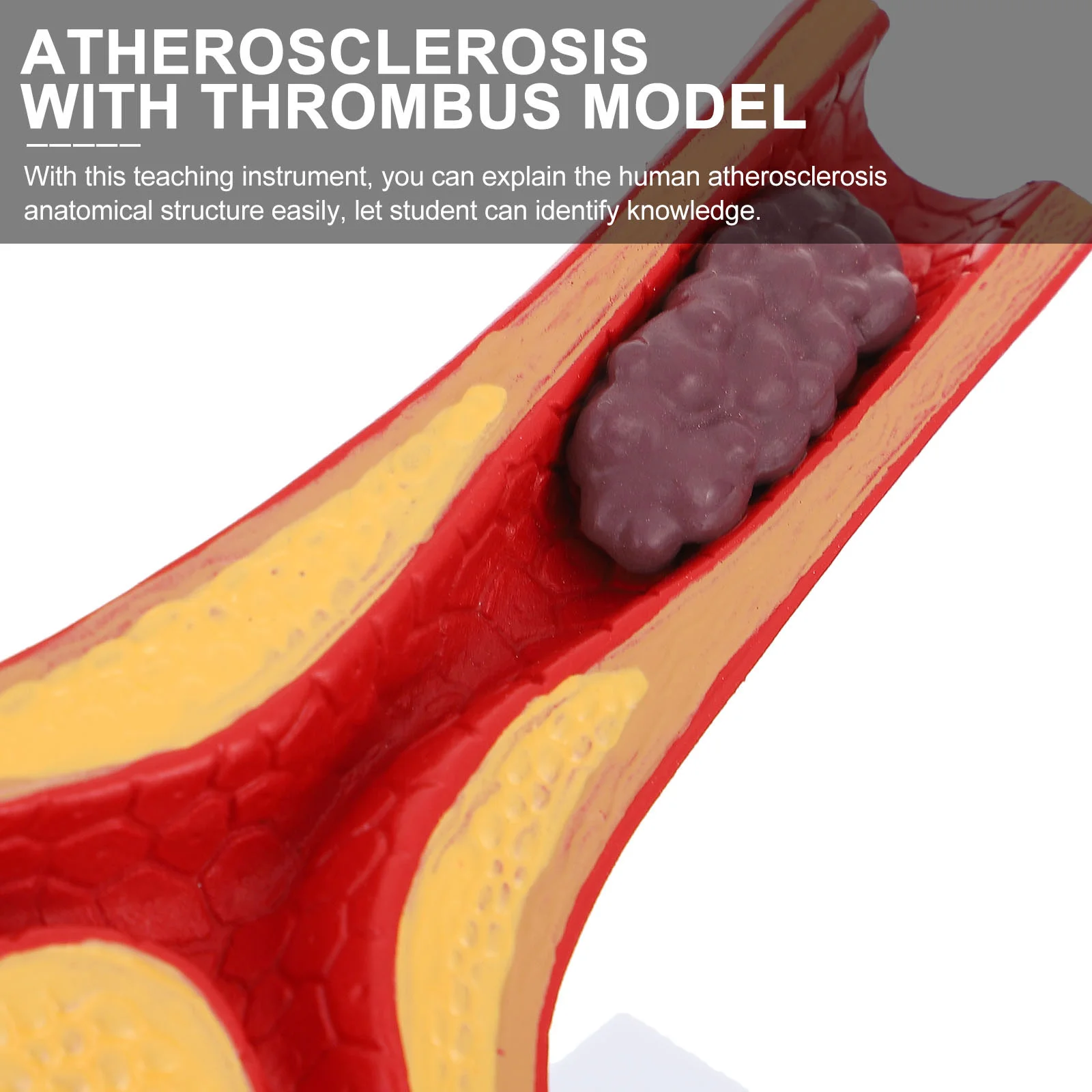 Vascular Model Atherosclerosis Display Human Anatomical Models Cardiovascular Teaching Vacuum