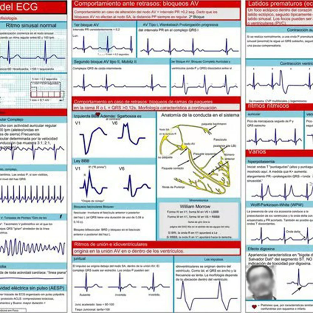 Self Test Ruler Pocket Card for Rapid Diagnosis and Examination Review Essential Resource for ACLS Rhythm Analysis