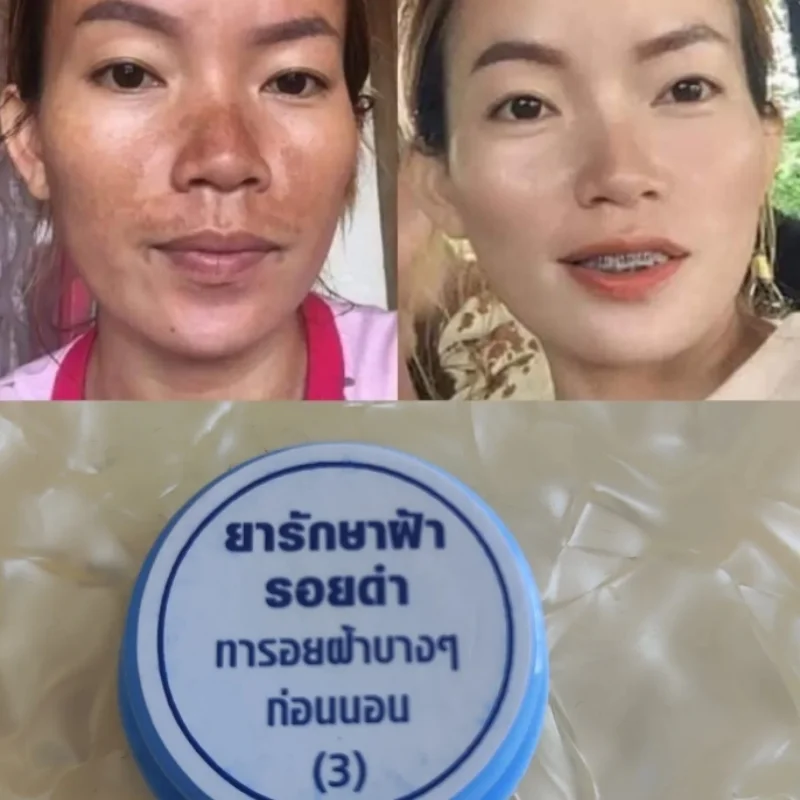 

Тайское традиционное лицо Ярко-белое удаление веснушек, темных пятен, пятен, прыщей, увлажнение, осветление мягкой и гладкой кожи