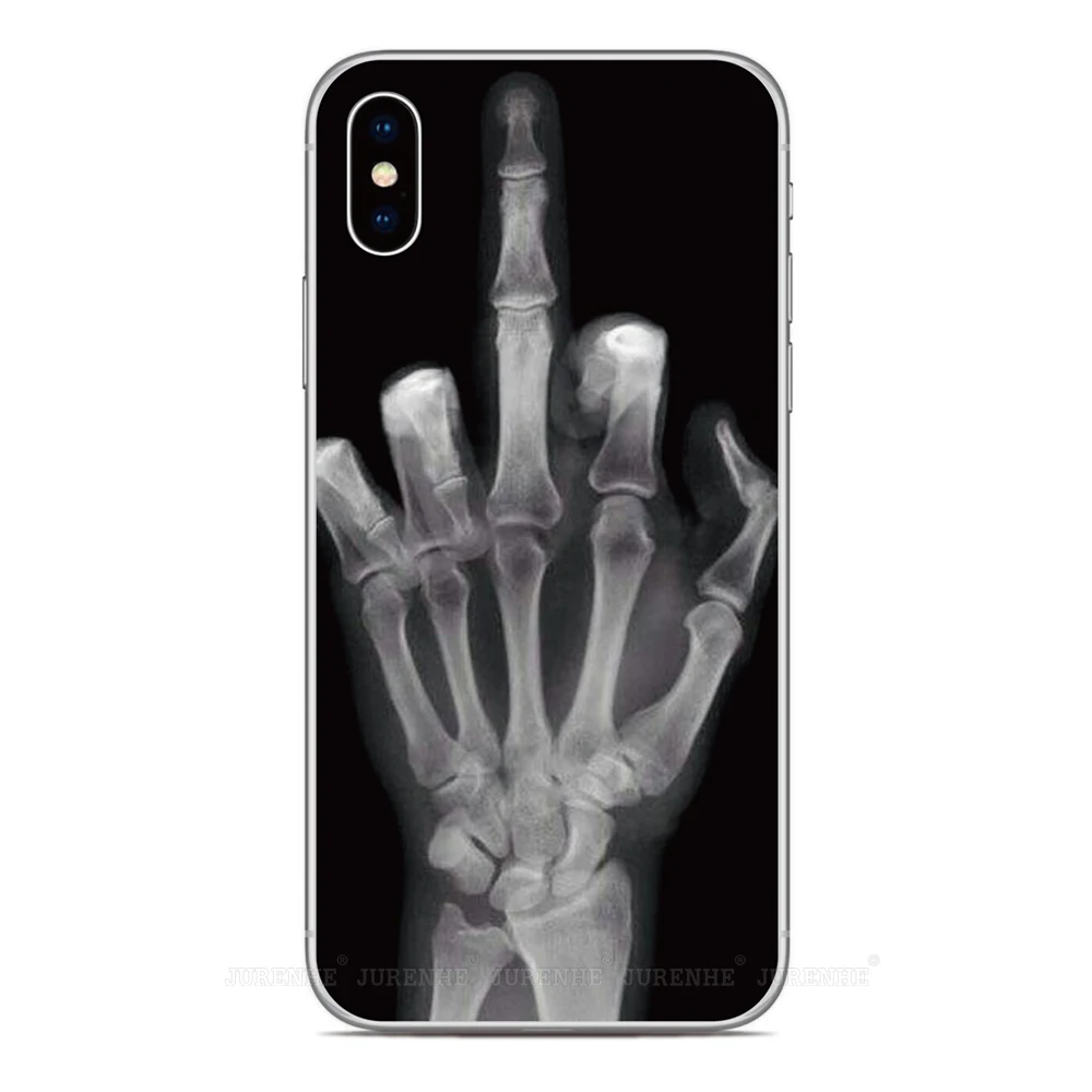 Middle Finger Case For Alcatel 1B 1S 1SE 1L 1A 3 1 5033D 3X 1C 1X 1V 2019 2020 2021 2022 Nothing Phone 2A Plus CMF 1 2 Cover