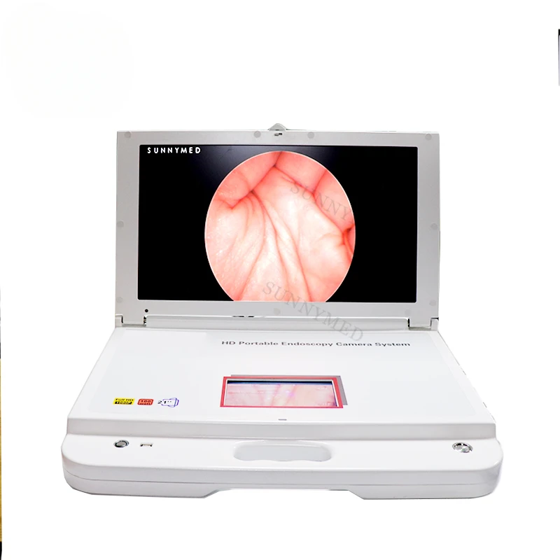 SY-PS046 Hysteroscopy system medical HD endoscope system arthroscopy