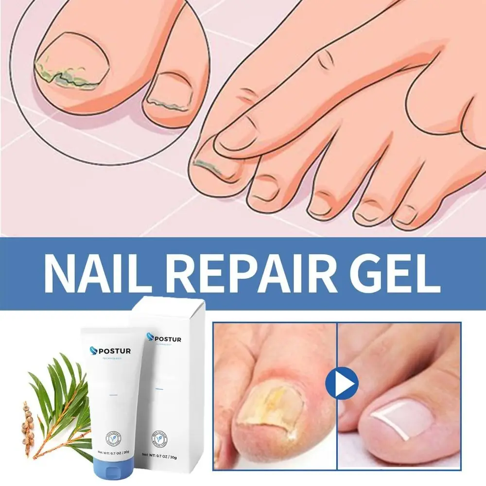 Nagelreparatie Nagelgel Verbetert Barrièrefunctie Verfrissende Schimmel Gel Hydratatie Gemakkelijk Te Absorberen Nagelverzorging Gel