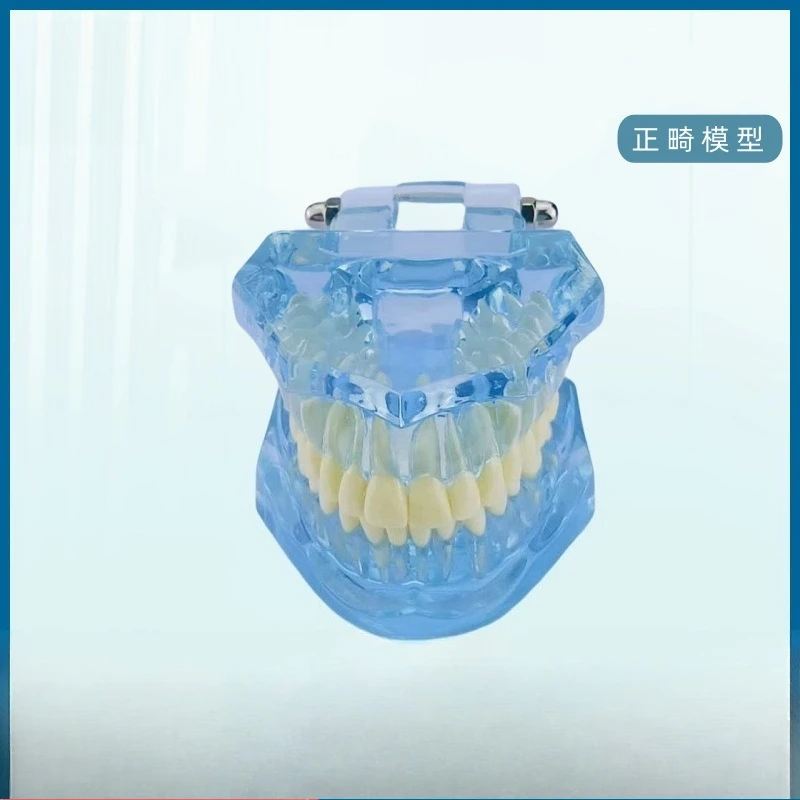 Restoration model, dental pathology, doctor-patient communication, teaching prosthosis, comprehensive removable dental mold