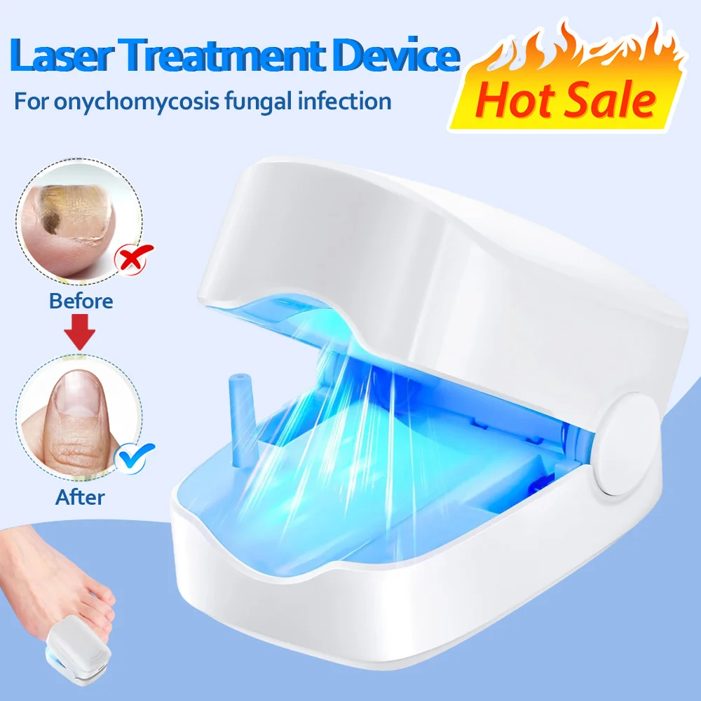 

Portable Grey Nail Assist Tool UV Professional Nail Fungus Cleaning Laser Device Nail Phototherapy Lamp Type-C Charging Wholesal