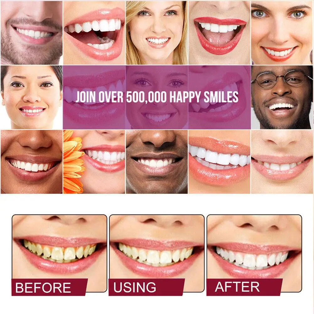 Probiotic Whitening Toothpaste Remove Plaque Stains Yellow Tooth Fresh Breath Protects Gums Dental Bleaching Repair Tools 120g