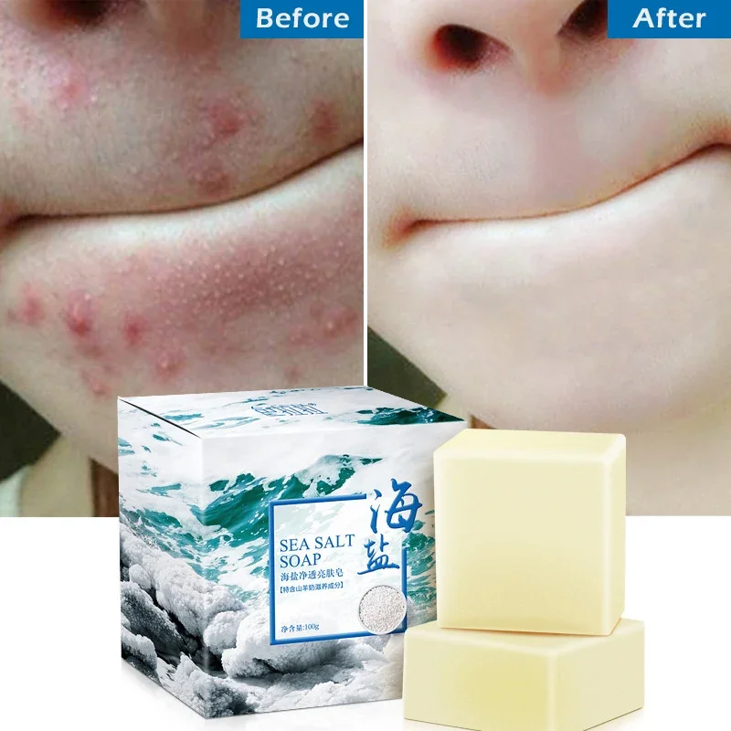 Sea Salt Soap Whitening Moisturizing Wash Base Removal Pimple Pores Acne Treatment Face Care Wash Basis Soap Shower