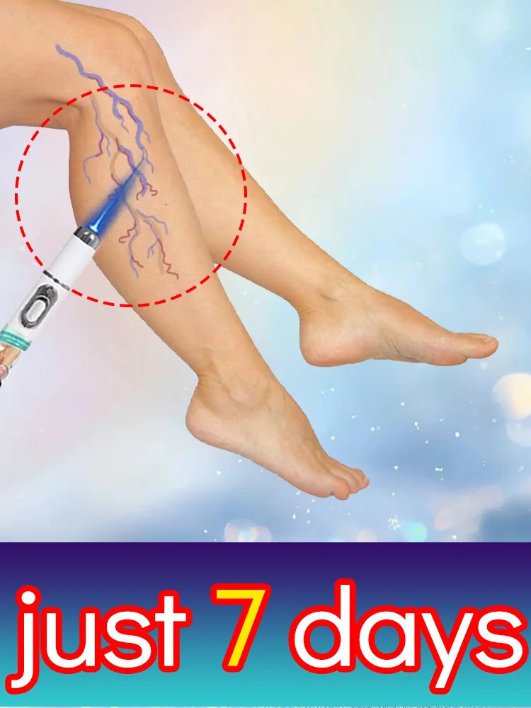 

2025 г. Синий лазер второго поколения. Проблемы проблем с инструментами.