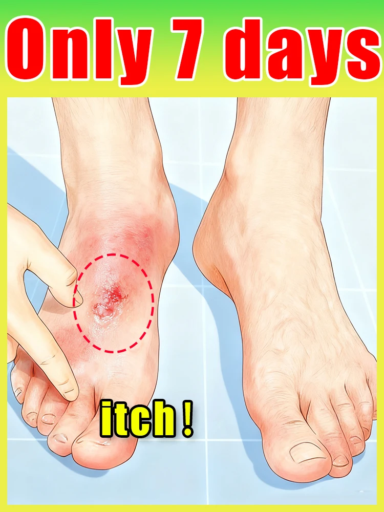

Foot care tools to help relieve itching and say goodbye to itchy feet.