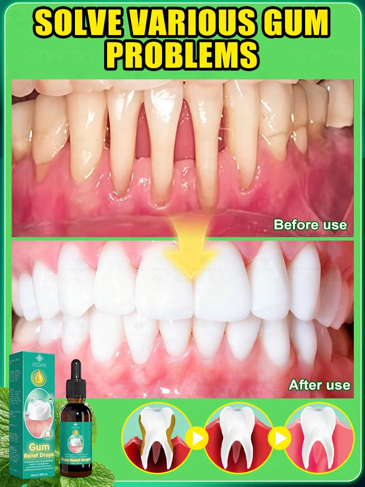 

Stimulates natural regeneration and coverage of teeth, restoring a healthy oral cavity.