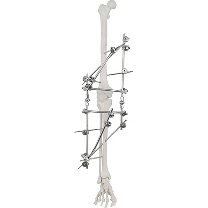 جودة مضمونة مثبت خارجي نصف دائري جراحي