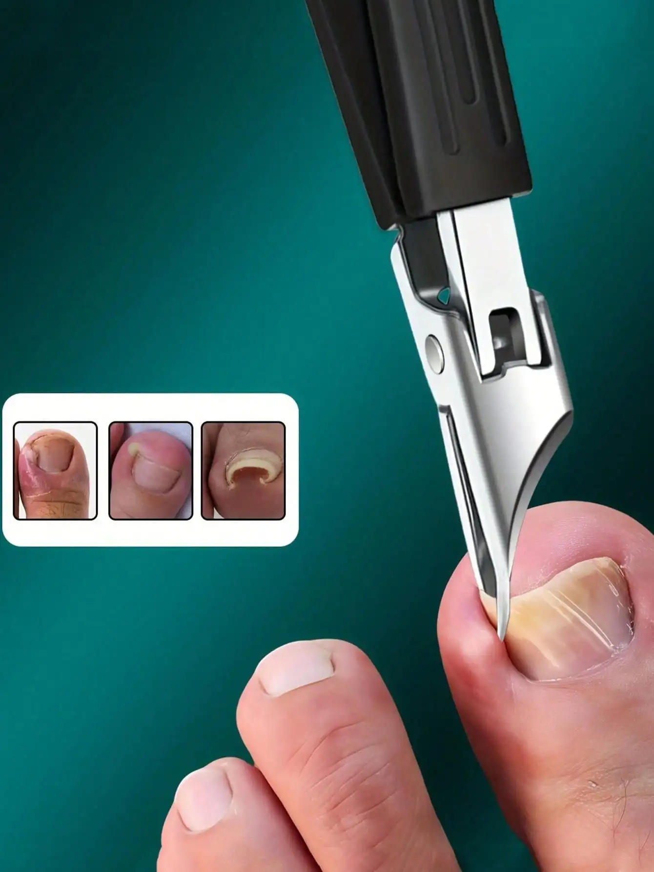 1pcHigh Precision Trimmer Suitable For Thick And Ingrown Nails, Made Of Quality Stainless Steel With Safety Soft Handle And 25 Degree Angled Ultra-Sharp Blade. This Thick Nail Clipper Designed For Elderly Has Splash-Proof Function.