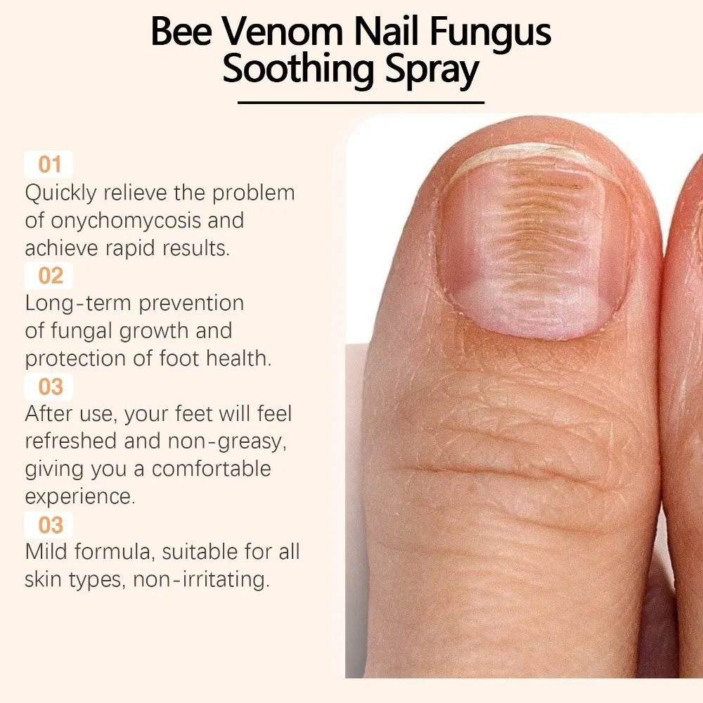 Skin Soothing Bee Venom Nail Soothing Spray Treatment Natural Bee Venom Extract Nail Growth Spray Nail Cleaning Spray