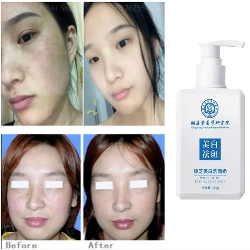 Poros Shrink Brightening Facial Cleanser, Remoção De Sardas, Controle De Óleo Refrescante, Limpeza Profunda, 150g
