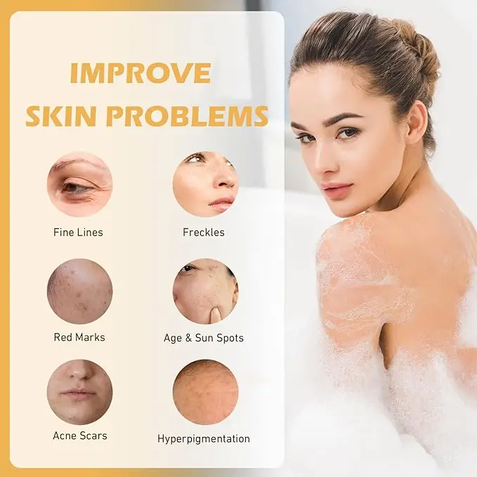 Kójico jabón de ácido para manchas de cúrcuma, jabón para acné, jabón blanqueador con vitamina C, vitamina E, limpieza profunda y blanqueamiento de la piel