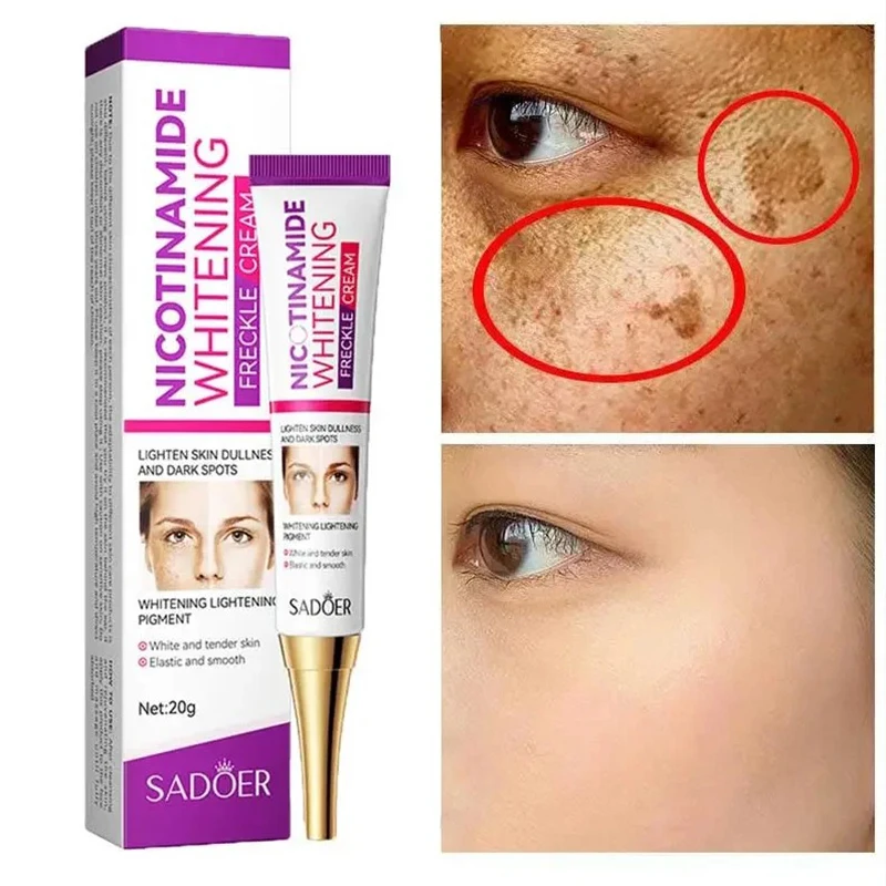 

Nicotinamide Remove Melasma Dark Spot Whiten Freckle Cream Lighten Melanin Brightens Skin Tone Moisturize Face Skin Care Makeup