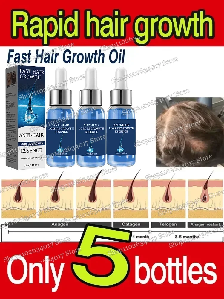 Anti Hair Loss Scalp Treatment Serum Beauty Health Products Fast Hair Growth for Men Women Ginger Oil Care