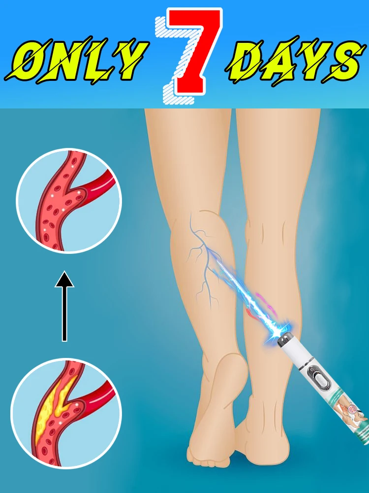 

blue light pen solve varicose veins, hot sale leg care tools