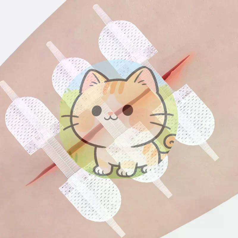 *1Pc Strap Zipper Wound Closure Patches Breathable Seamless Elastic Zip Sutures Bandages For Wound Care Braces Supports