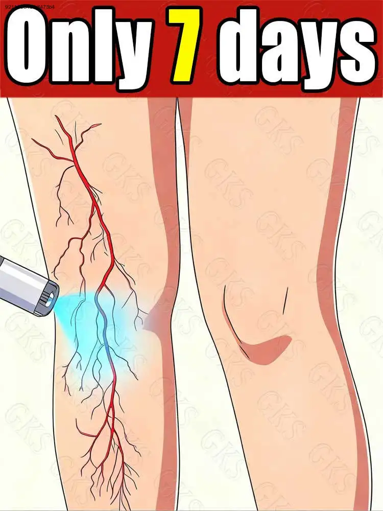 Aᴅᴅʀᴇssᴇs ɪssᴜᴇs ʀᴇʟᴀᴛᴇᴅ to veins, spider legs, and prolonged sitting or standing.