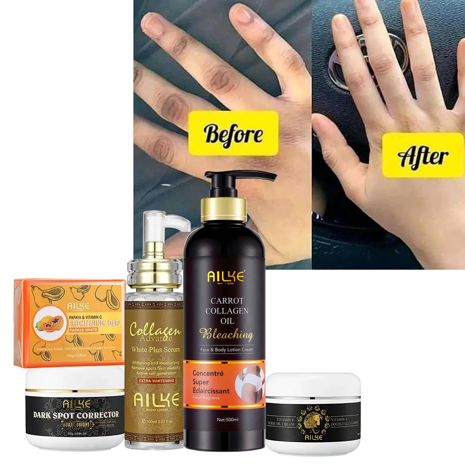 

Набор для ухода за кожей AILKE, с никотинамидом, глутатионом, увлажняющим, ровным тоном кожи, удалением темных пятен, веснушек, меланином