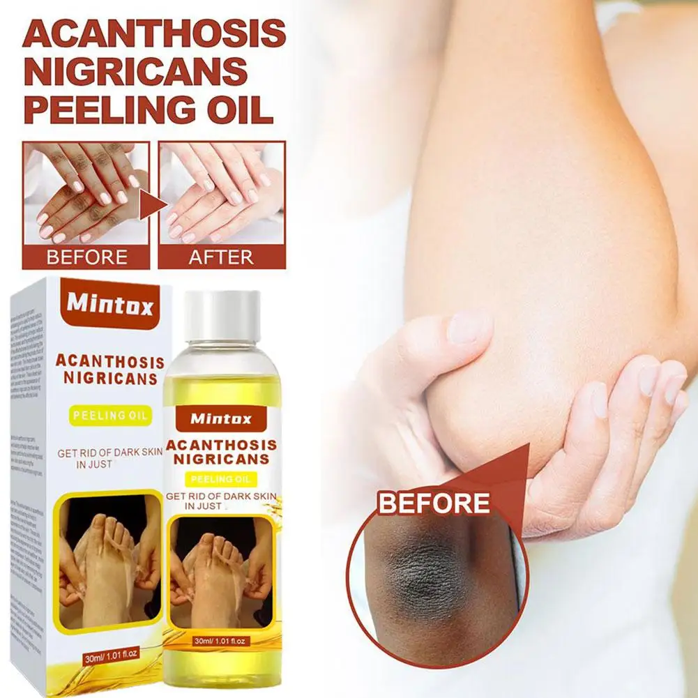 2pcs Body Peeling Oil Elbow Knee Finger Yellow Oil For Skin Brightening Moisturizing Removes Dead Skin Care