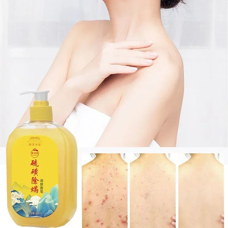 400/500ml Sulfur Mite Bath Lotion Deeply Cleans Acne Inhibits Bacteria Relieves Itching Refreshes Moistens Liquid body wash