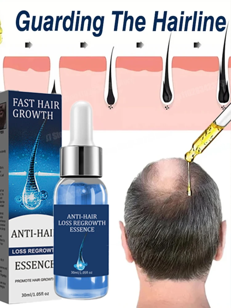 

Fast Hair Growth Oil Baldness Repair Hereditary Hair Loss Postpartum Seborrheic Hair Loss Oil